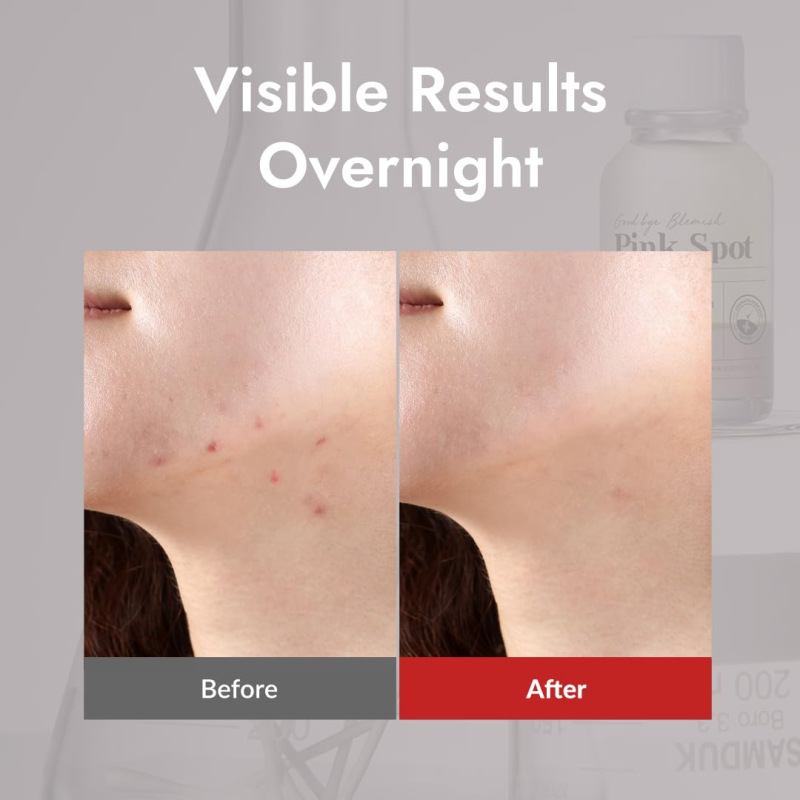 MIZON Good Bye Blemish Pink Spot – lokálne nočné ošetrenie akné 4
