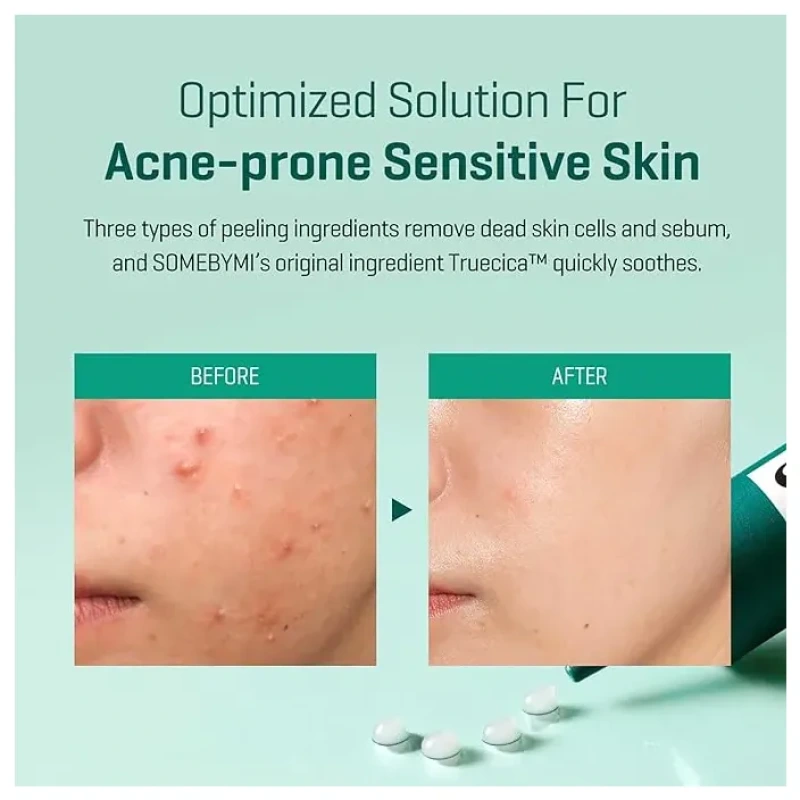 SOMEBYMI AHA.BHA.PHA.14 DAYS Super Miracle Spot All Kill Cream 30 ml 4