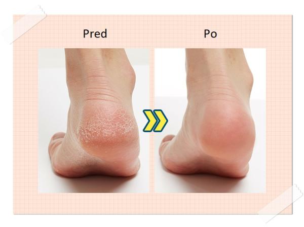 APIEU Soft Foot Peeling Socks