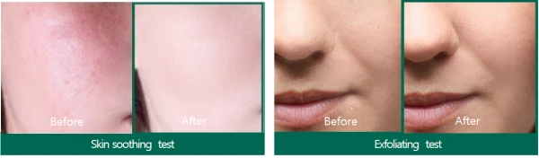 SOMEBYMI AHA-BHA-PHA 30 days Miracle Serum, 50ml 2