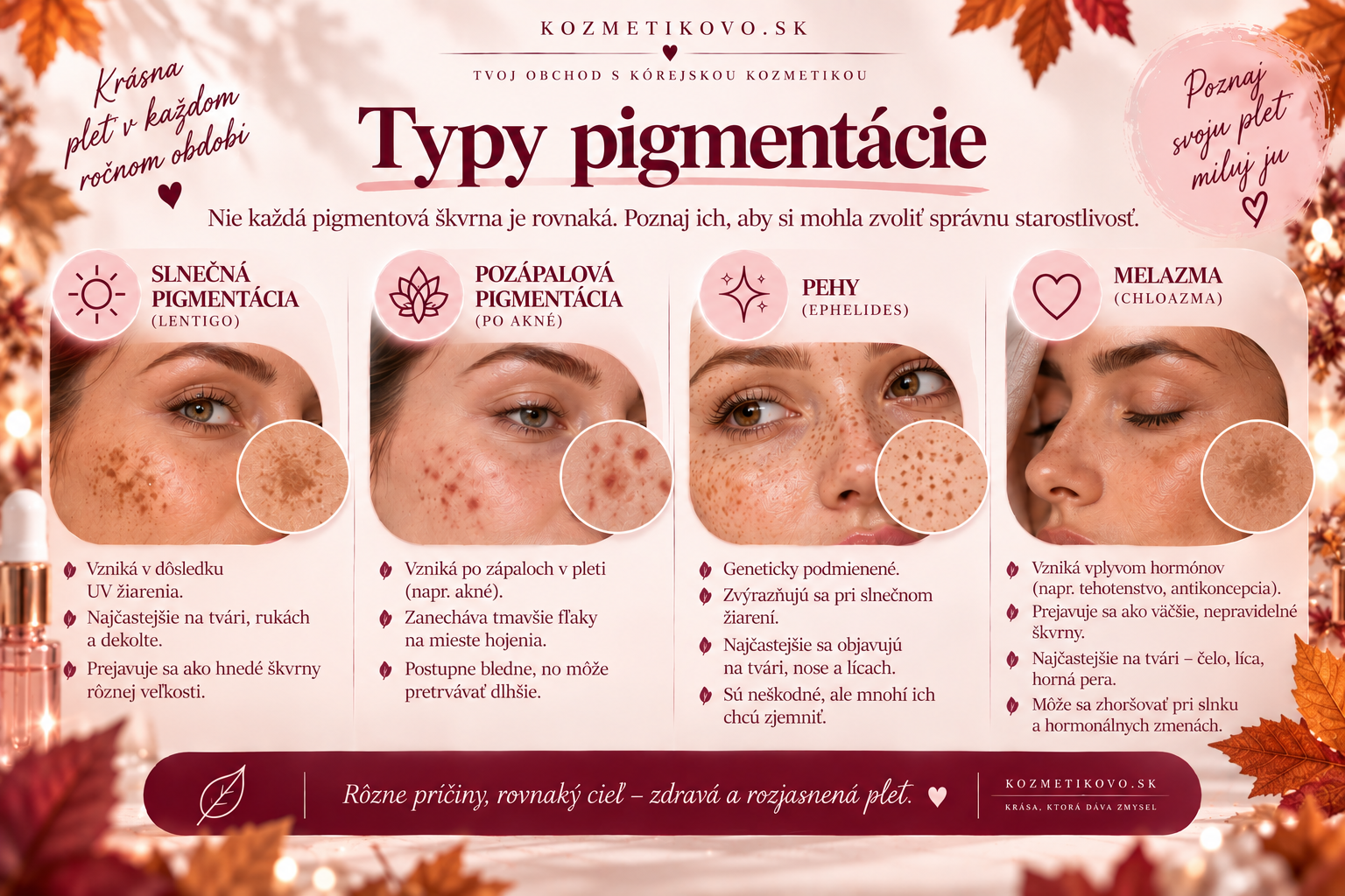 Typy pigmentácie pleti: slnečné škvrny, pigmentácia po akné, pehy a melazma